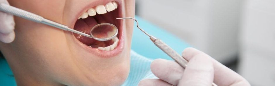 How Often Should You Go to the Dentist for Teeth Cleanings?